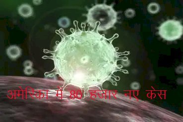 विश्व में कोरोना के सर्वाधिक नए मामले अमेरिका में, वैक्सीनेशन कराने वालों को मिल सकते है 100 डॉलर