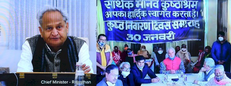 कुष्ठ निवारण दिवस के उपलक्ष में सीएम गहलोत ने कुष्ठ रोगियों की सेवा का संकल्प लेना की अपील की