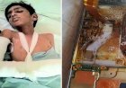मोबाइल बैटरी में धमाके के साथ ब्लास्ट, ऑपरेशन कर काटनी पड़ी 5वीं कक्षा के बच्चे की हथेली