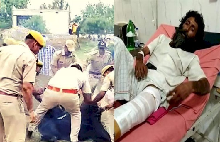 भरतपुर में अब संत के तोड़ दिए हाथ-पैर, अस्पताल में चल रहा इलाज