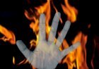 यूपी : प्रेमिका के परिवार ने प्रेमी को लगाई आग, हालत गंभीर