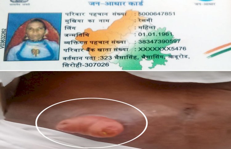 पेट से बाहर निकल रही गंभीर बीमारी के दर्द से तड़प रहा मरीज! खर्चा अधिक, नहीं करा पा रहा इलाज़